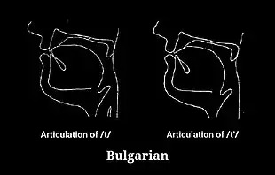 Articulation of t and tʲ in Contemporary Standard Bulgarian